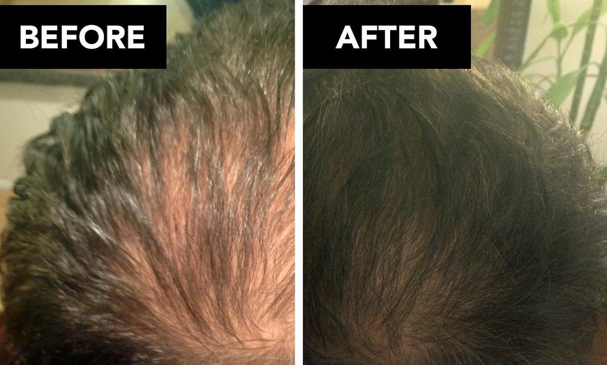 Image 6: Boost Hair Health with Scalp Care Consultation! 