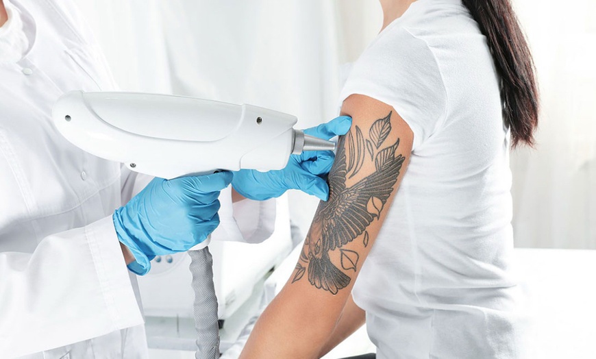 Image 1: 3 o 6 sesiones de eliminación de tatuaje de hasta 10 x 10 cm para 1