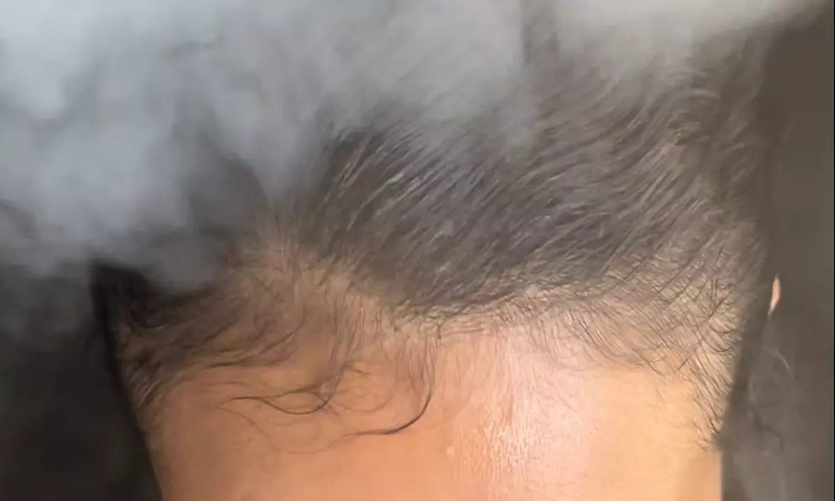 Scalp Detox Treatment With Soothing Massage