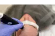 Experience the Deluxe HydraFacial MD at SkinFit by Anneliese with mask & LED light therapy, offering up to 49% off - Second Medium