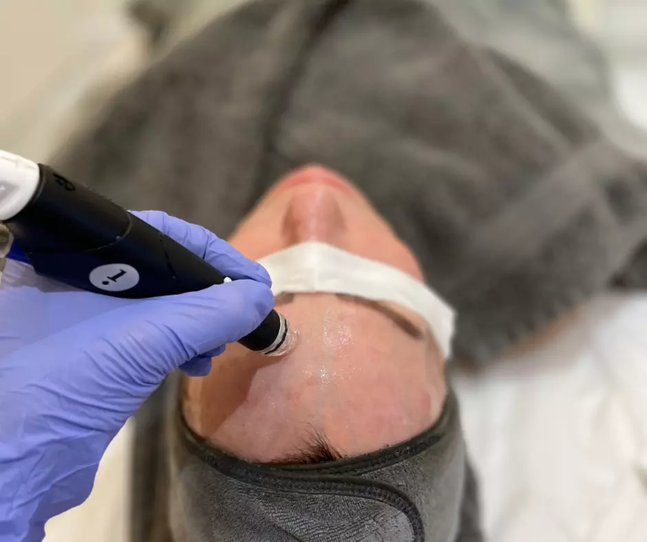 Deluxe HydraFacial with Mask & LED Light Therapy Options