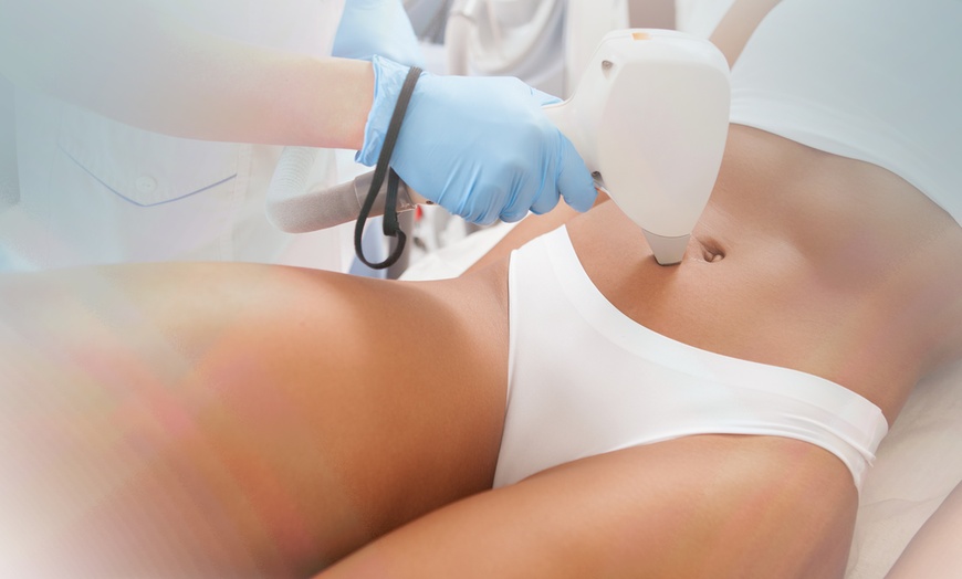 Image 3: Up to 75% Off on Laser Hair Removal at SwissLaserUK