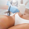 Image 3: Up to 75% Off on Laser Hair Removal at SwissLaserUK