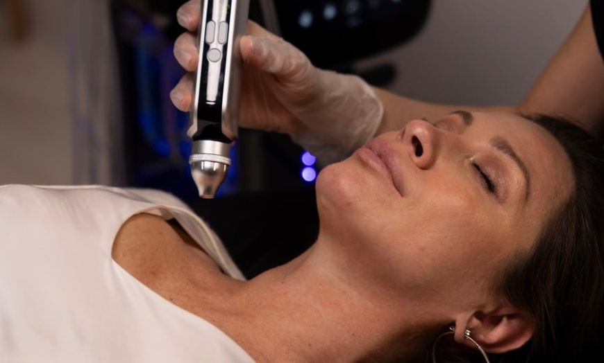 Image 4: Up to 60% Off on Mesotherapy - Needleless at Nova Luna Wellness