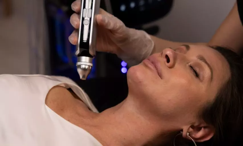 Up to 64% Off on Mesotherapy - Needleless at Nova Luna Wellness