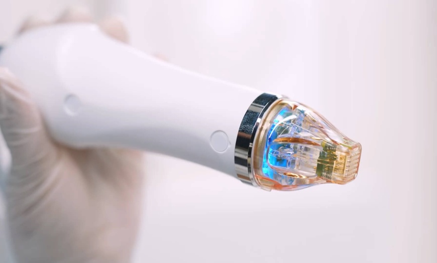 Image 2: Tighter, Smoother Skin: Secret RF Microneedling for Face or Décolleté