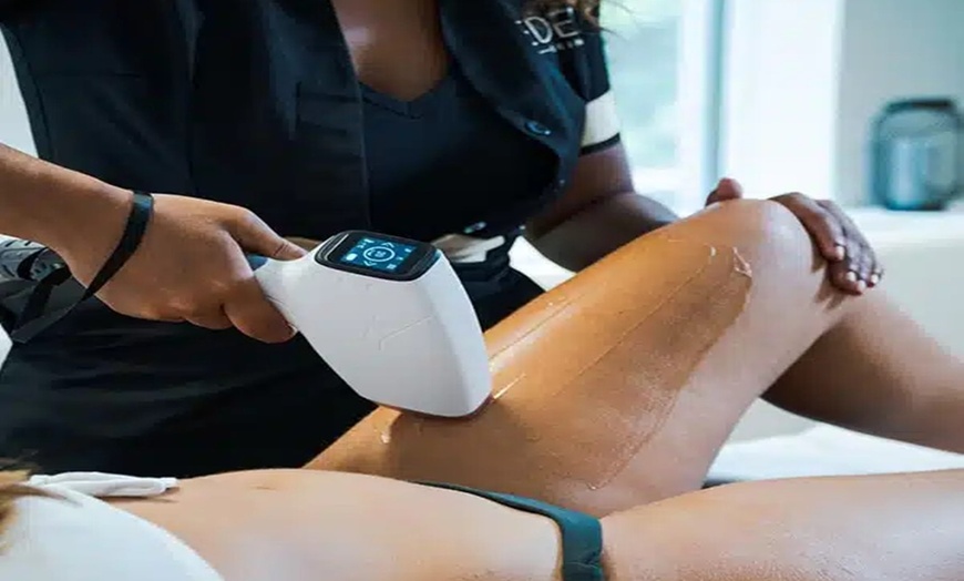 Image 1: Dites adieu aux poils avec une séance d’épilation ciblée