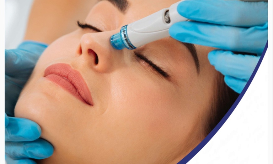 Image 1: Refresh and Renew with One or Two Hydrodermabrasion Facials 