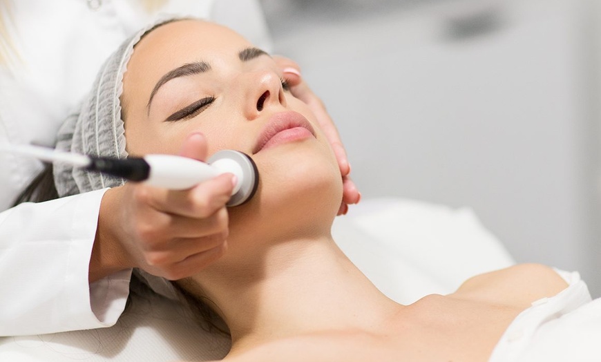 Image 2: Chemical Peel or Microdermabrasion Facial