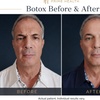 Image 2: Half or Full Syringe of Juvederm Ultra XC or Full Syringe of Juvederm 
