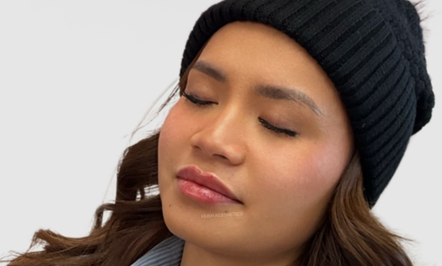 Image 2: Enhance Your Features with Half or Full Syringe of Restylane Filler 