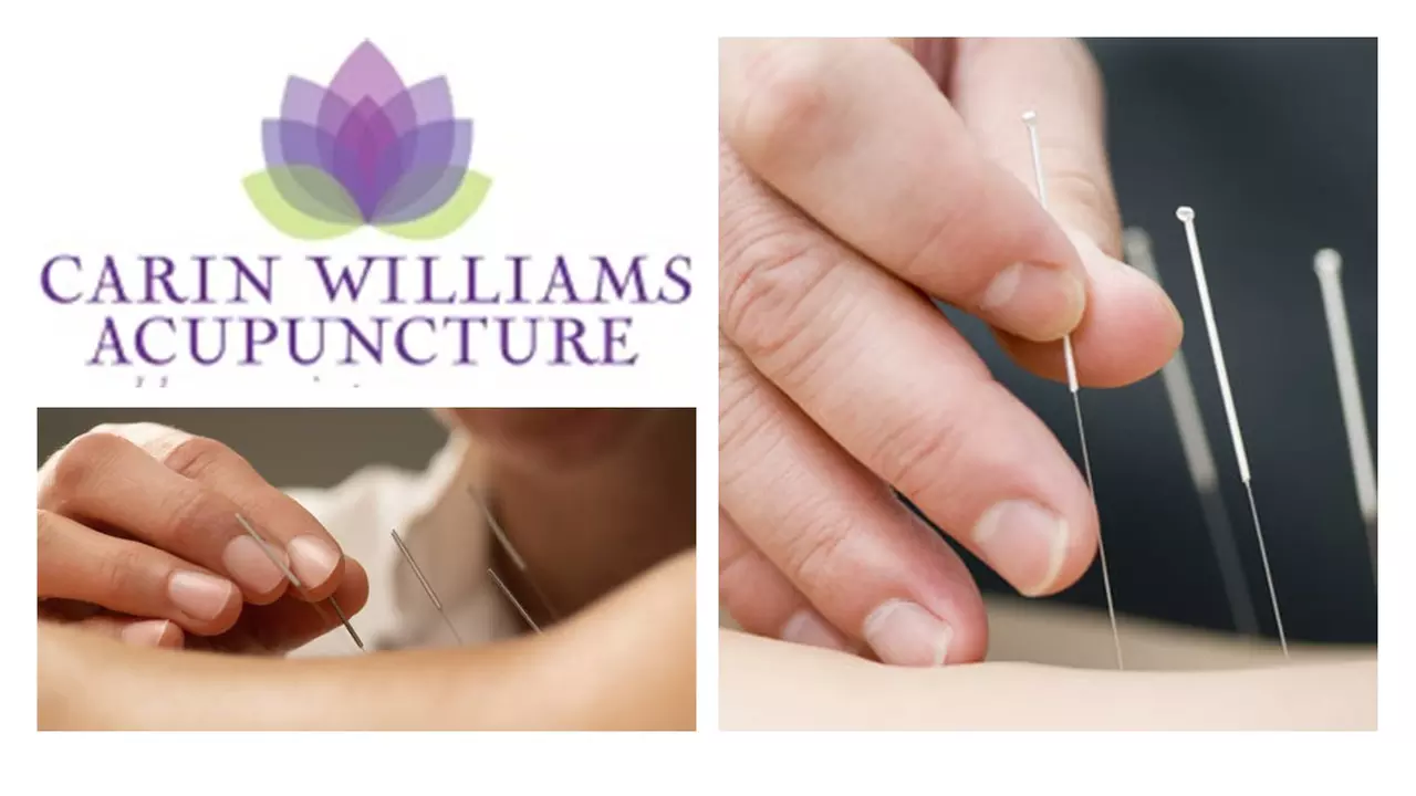 Embrace Personalized Wellness at Carin Williams Acupuncture on Two Acupuncture Sessions and Consultation (Up to 50% Off) - Primary Image