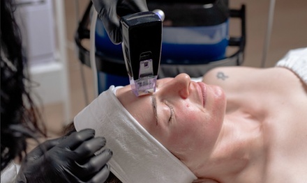 1 Session of Morephus8 Face/neck OR Body - Nuvera medspa Sculpt lift glow