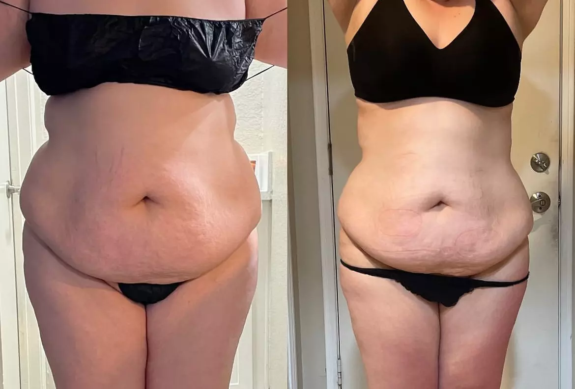 Up to 50% Off on Cavitation at Divine’s_Sculpting