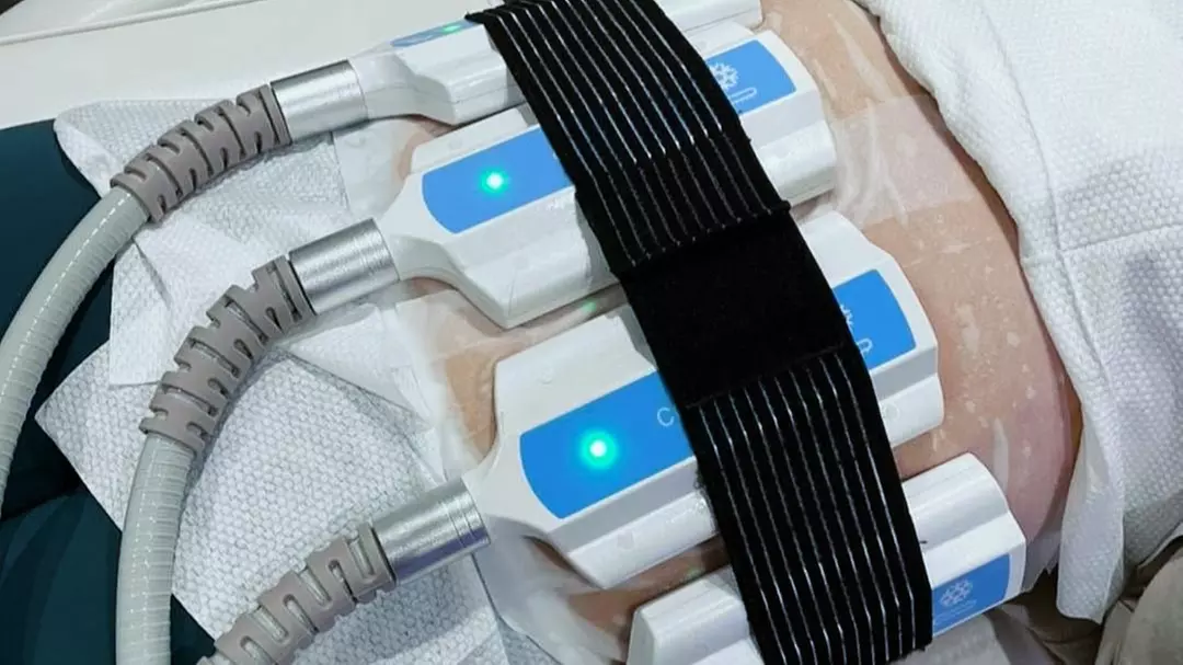 One CryoSlim Body Contour &amp; Tone &amp; Optional Red Light Therapy &amp; More