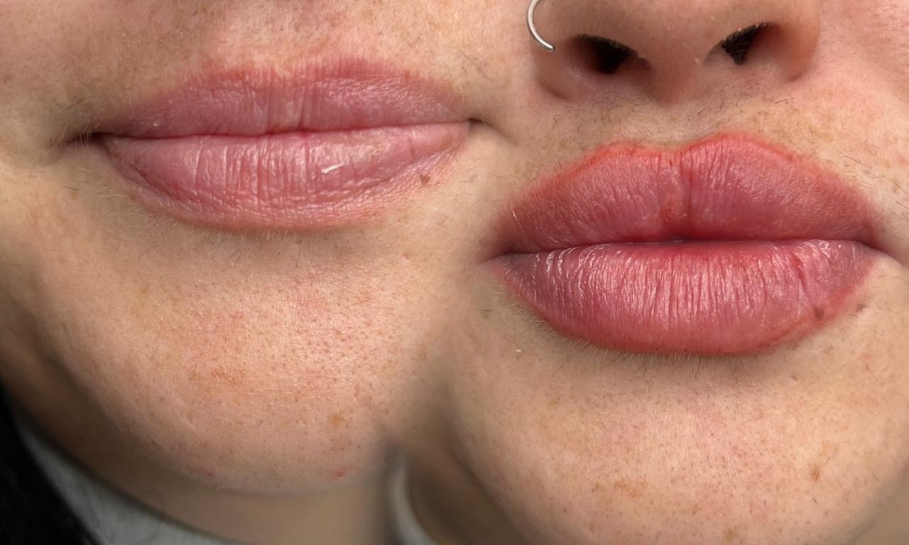 Micropigmentación de labios efecto natural con opción a repaso para 1