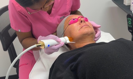 One Auralift RF Microneedling Treatment for Full Face - Balanced Bodies Wellness Decatur LLC