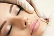 Personalized 20, 40, or 60 units Xeomin Injections for Flawless Skin at La Belle MedSpa (Up To 43% Off) - Image 2