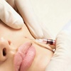Image 2: Enjoy 20, 40, or 60 units Xeomin Injections for Age-Defying Skin