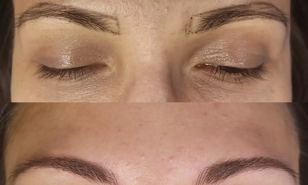 Achieve Effortless Brows with Microblading! 