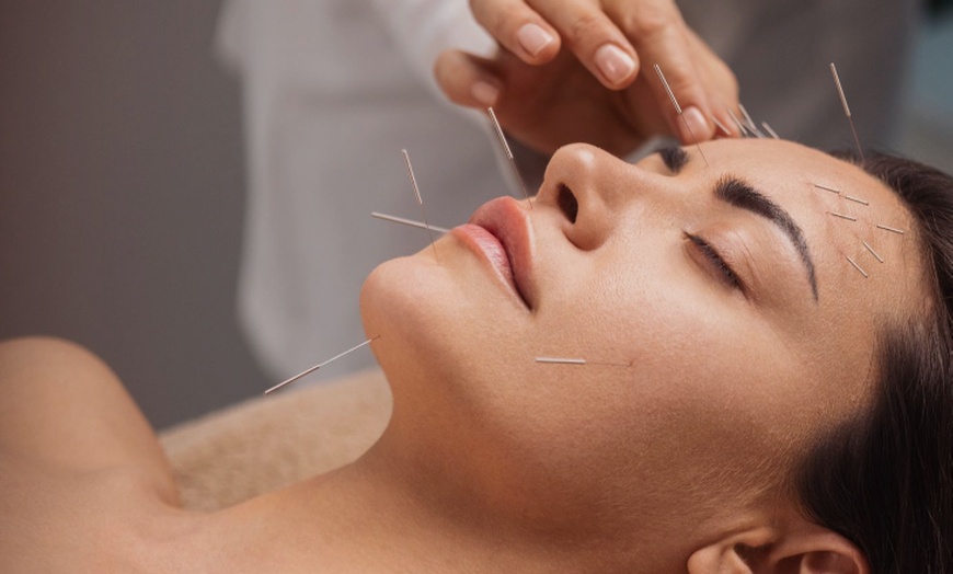 Image 2: Cosmetic Facial Acupuncture + Aromatherapy Booster Facial Toning Mists