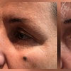 Image 4: Transform with HIFU Treatment on Neck, Half or Full Face or Body 