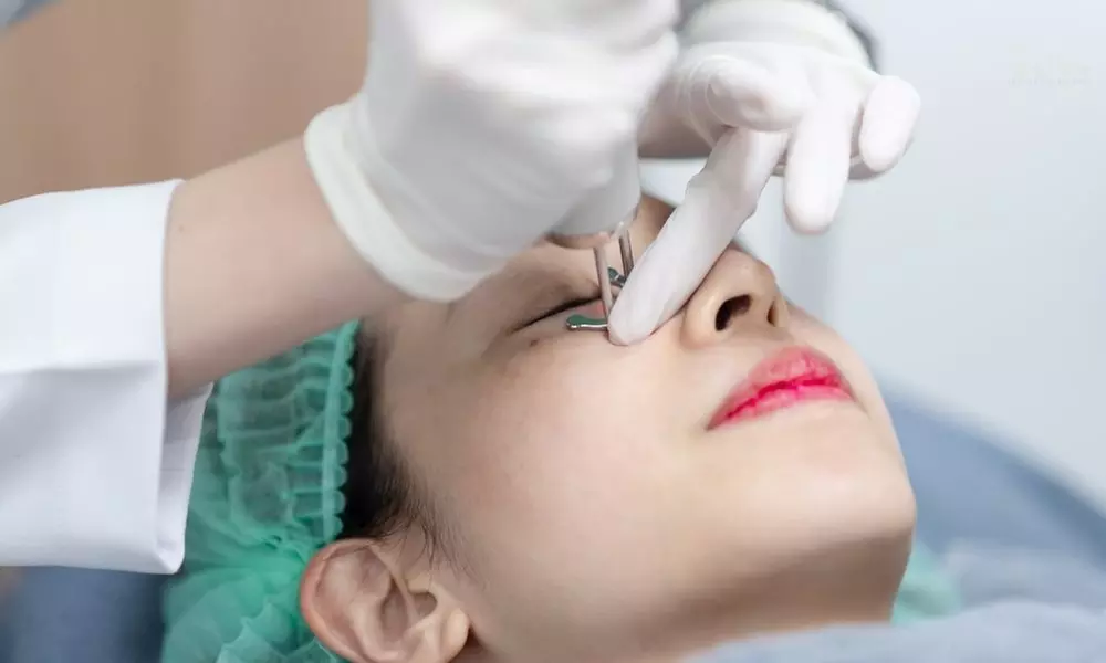 PICO Laser Treatments for Dark Spots + Optional Hydrofacial Add-On