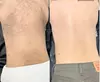 Ultimate Smoothness with Skin Beauty By Thalita's 1,3, or 6 Laser Hair Removal For 2 Small Areas (Up to 55% Off)