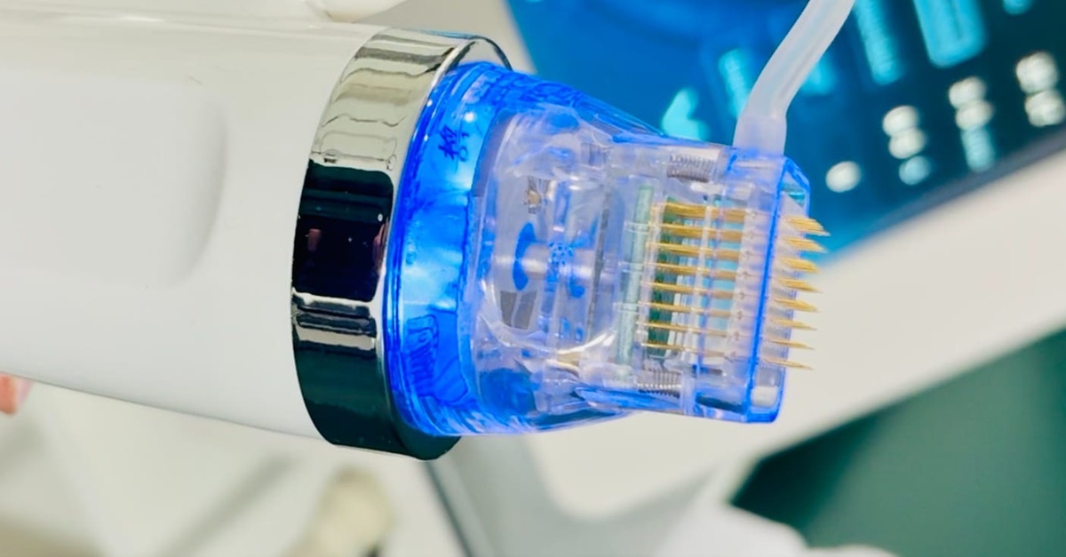 Tratamiento de microneedling facial con radiofrecuencia en Tarragona