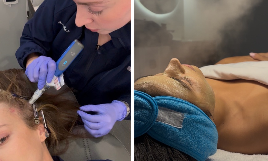 Image 2: Enhance with 20, 40 or 60 Units of Daxxify Plus 1 Syringe RHA (1ml) 