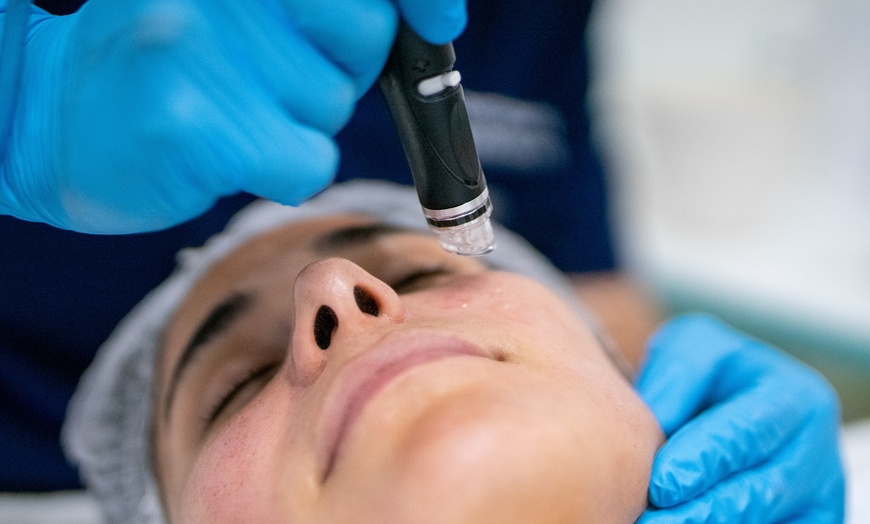 Image 1: Up to 25% Off on Facial - HydraFacial at Derma Consult Skin Specialist