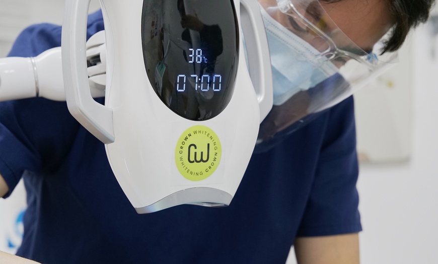 Image 4: In-Office Crown Whitening Treatment with Consultation and Optional Whitening Kit at Green Dental (Up to 52% Off)