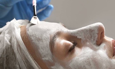 Peeling redermalizujący z TCA na twarz + maska liftingująca - ES Beauty Cosmetology