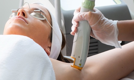 Six Laser Hair Removal Sessions on One Small Area - Forever Slender MedSpa