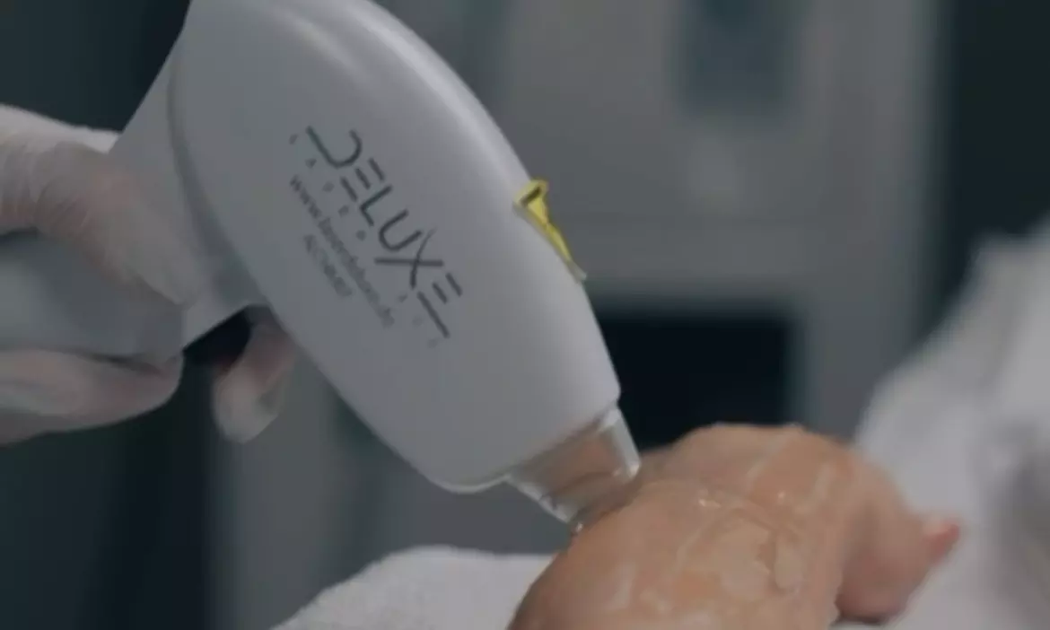 Diodenlaser-Haarentfernung für Achseln, Intimbereich od. ganzen Körper