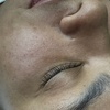 Image 2: Limpieza facial de 60 minutps con peeling enzimático o rutina completa