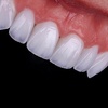 Image 1: Dental Crowns, Dental Exam, X-rays & Cleaning, Dentures & More
