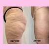 Image 1: Two or Three VelaShape III at Beauty Factory Boutique Spa 