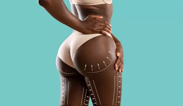 Up to 50% Off on Non-Surgical Butt Lift at SNATCHDSKIN - Primary Image