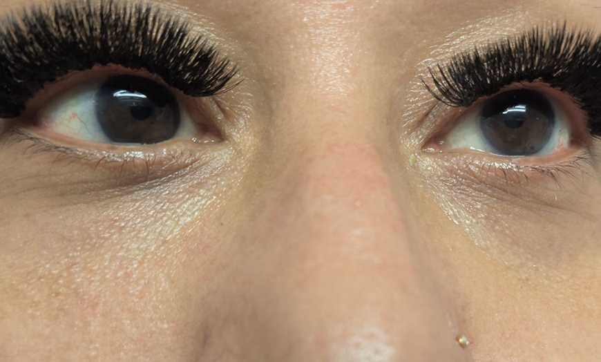 Image 2: Target Dark Circles & Puffiness: PRF Under-Eye Therapy (1/ 3 Sessions)