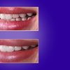 Image 4: Transform Your Smile with Custom Teeth Whitening
