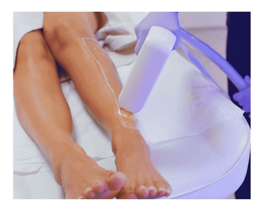 Laser Hair Removal XS Area - 8 Treatments - Impact Medical Cosmetics