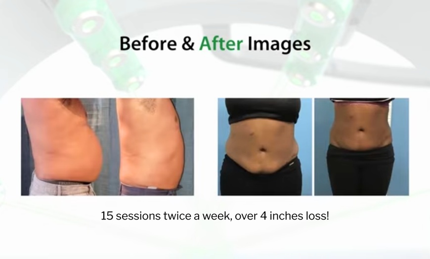 Image 2: Emerald Laser Fat Loss - Up To 4 inches Loss