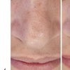 Image 9: Up to 31% Off on HydraFacial at Phoenix Esthetics of CT