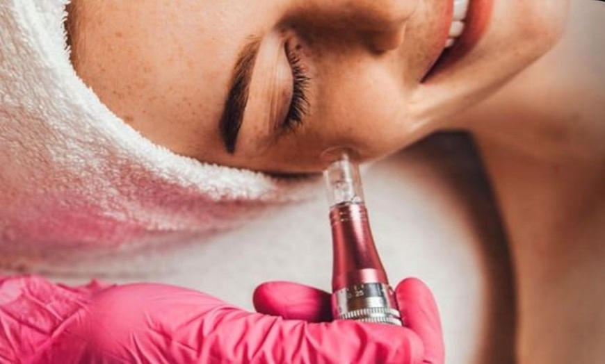 Image 7: Up to 56% Off on In Spa Facial (Type of facial decided by customer) at Glow with Eliza