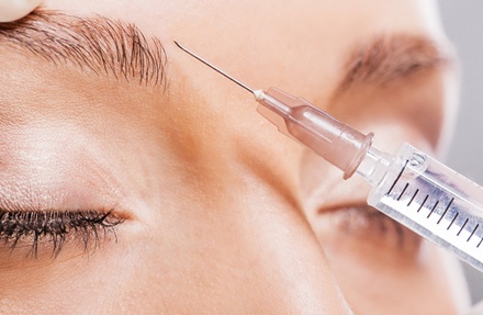 Wygładzanie zmarszczek toksyną botulinową: 1 okolica - Richter Clinic Iwona Richter