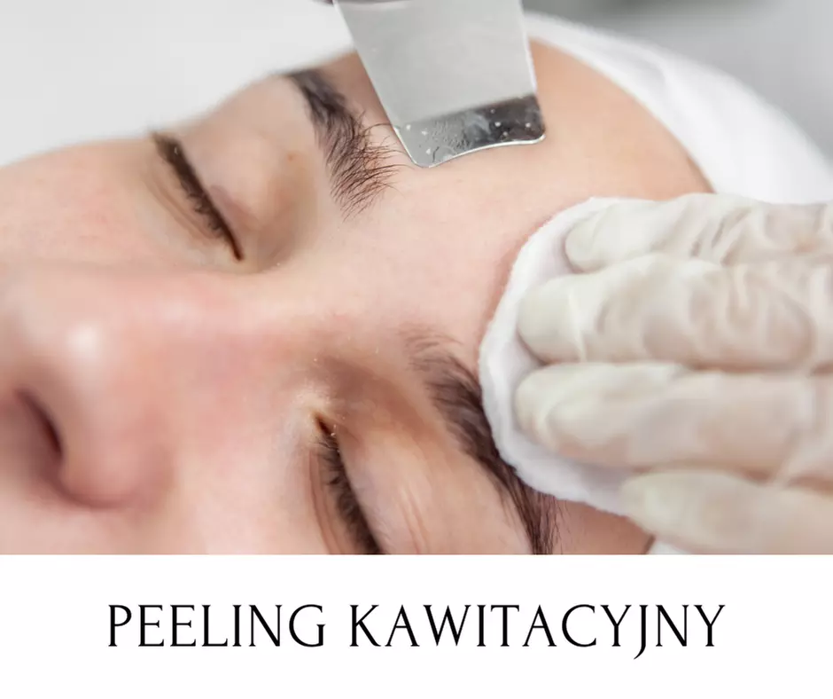 Karty podarunkowe do wydania na usługi w salonie Estetic World