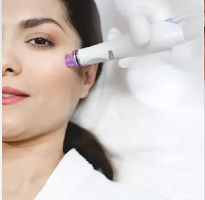 Up to 23% Off on Acne Treatment at Elite Skin Aesthetics - Primary Image