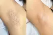Ultimate Smoothness with Skin Beauty By Thalita's 1,3, or 6 Laser Hair Removal For 2 Small Areas (Up to 55% Off) - Second Medium