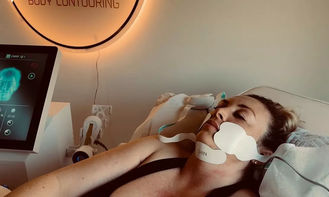 Non-Invasive Face Lifting Treatment – Perfect Face NEO 1 or 4 Sessions